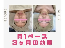 ココポキ 岐阜店/エステメニュー