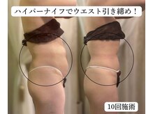 サロンハート(Salon Heart)