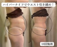 サロンハート(Salon Heart)