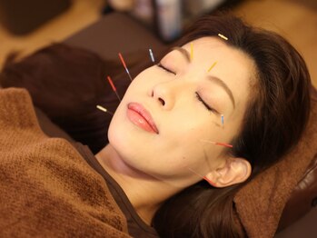 ナラワ(NARAWA)の写真/鍼が初めての方にもおすすめ◎刺激が弱いもの~ちょうど心地よい強さに合わせて施術を行います♪