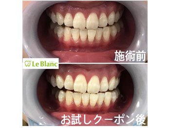 ルブラン 奈良店(Le Blanc)/キャンペーン中です