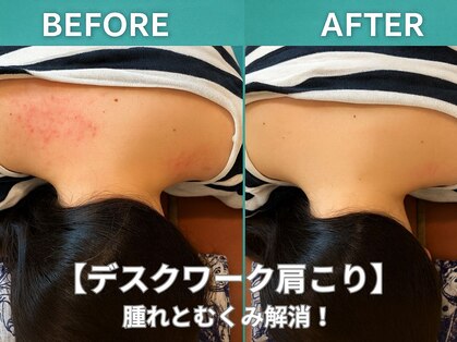 ターコイズ(Turquoise)の写真