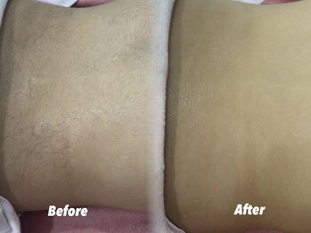 クイーン 渋谷店(QUEEN)/背中全体シェービング