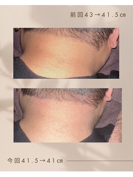 サン(Sun)の写真/スゴ腕施術者が頭首肩をほぐすだけで見た目が変わる、究極のリラクゼーション体験☆