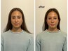 【顔の歪み×左右差ケア】骨格調整オールハンドコース
