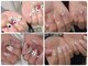 リノネイル(Rino-nail)の写真