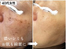 パールホワイトニングサロン 辻堂店