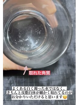 オレンジ(Orange)/【顔全体】毛穴・角質ケア120分