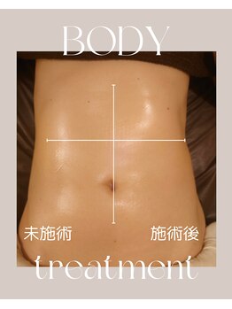 ルポ(repos)/お腹のサイズダウン