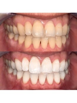 ライトビューティー 池袋店(LightBeauty)/症例写真