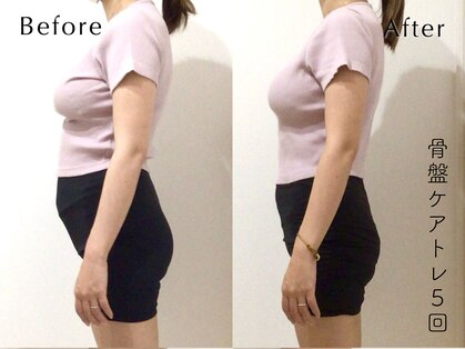 ペルビックハート(Pelvic Heart)の写真