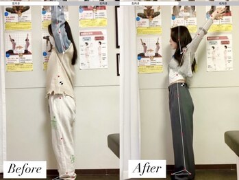 ナオル整体 浅草院(NAORU整体)の写真/デスクワークやスマホの長時間使用で首や肩のコリが限界の方に朗報！深層のコリにアプローチする整体技術★