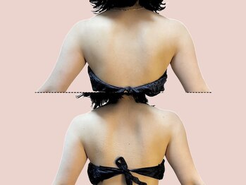 シェリートーキョー 成田店(Cherie Tokyo)/Before＆After /成田店