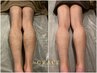 【こども脱毛/男の子】初めてでも怖くない♪腕&足脱毛が何度通っても 3,980円