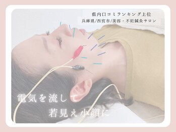 柚香鍼灸院/施術風景　妊活鍼灸