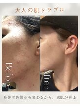 ヨサパーク クローバー 聖蹟桜ヶ丘店(YOSA PARK CLOVER)/Before/After