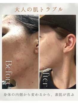 ヨサパーク クローバー 聖蹟桜ヶ丘店(YOSA PARK CLOVER)/Before/After