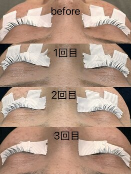 シュピネ(Choupinet)/◯d-max(トリートメント)◯