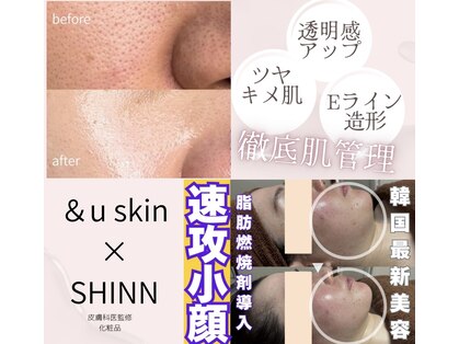 アンドユー(&u)の写真