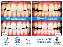 ホワイトニングカフェ 神戸元町店(WhiteningCafe)
