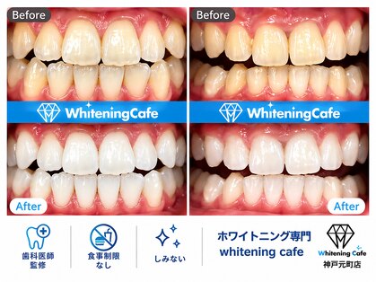 ホワイトニングカフェ 神戸元町店(WhiteningCafe)の写真
