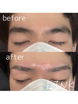 リンク(LINK)/眉毛症例