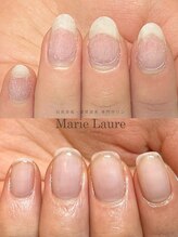 マリーロール 梅田店(Marie Laure)/自爪育成/深爪矯正/ネイルケア