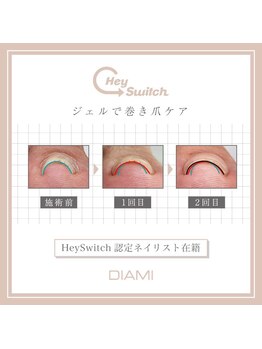 ル リアン 北浦和(le lien)/【巻き爪ケア】ヘイスイッチ