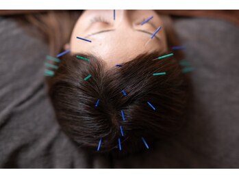 ゆる/ゆるイチオシの鍼灸ヘッドスパ　