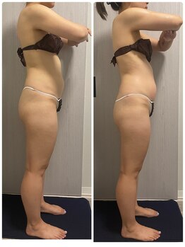 ディア 金町店(Dear)/5回の結果☆効果実感◎