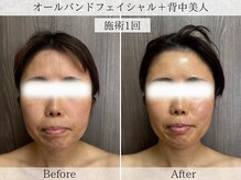 フラリ 西葛西(Hulali)/【40代】顔＋背中リラックスケア