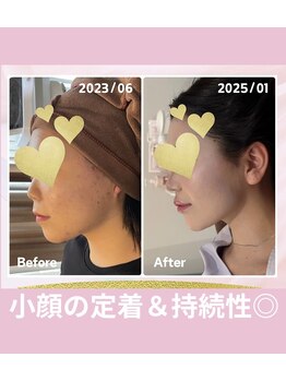 ウナ デ リンゴル 恵比寿店(UNA de Ringol)/初回¥13,500