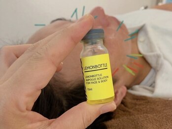 ノフ 恵比寿(noff)の写真/美容鍼は再来も同価格で継続しやすい♪より小顔になりたい方へ*脂肪分解成分【レモンボトル導入】新登場!