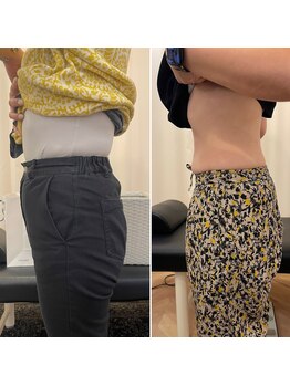 ナオ接骨院(NAO接骨院)/Before/After