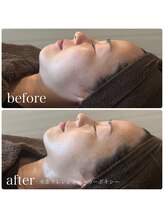 ブリス(BLiSS)/カーボキシー炭酸パック