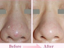 アースコアフュールボーテ 新鎌ヶ谷店(EARTH coiffure beaute)