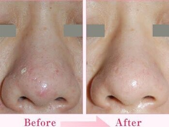 アースコアフュールボーテ 新鎌ヶ谷店(EARTH coiffure beaute)