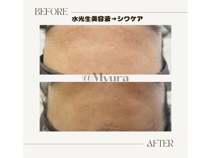 myuraの写真