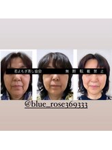 マロカ(Marroka)/【バラエティ蒸しの結果5】