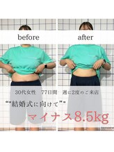 ダイエット工房 菊/結婚式に向けてダイエット/痩身