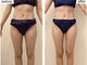 ルシエル ハカタ(Luciel HAKATA)の写真/【全身痩身】肩こりや首コリ、むくみや便秘など不調改善＆全身を温めながら痩身の組み合わせ。