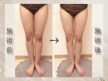 ミライ 福岡春日店(mirai)/美脚目指して集中ケア VenusDIVA