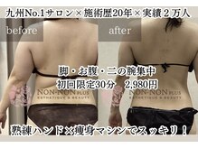 ノンノンプラス 博多(NON-NONプラス)