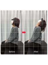 ナオル整体 山形院(NAORU整体)/Before→After【20代/女性】