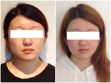 美容整体ウェリナ あま甚目寺院/小顔矯正/骨盤矯正/美脚サロン