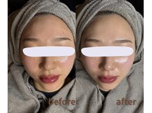 マリーメリー(marie merry)/【速攻小顔】水玉リフティング