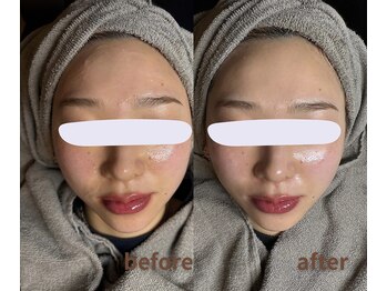 マリーメリー(marie merry)/【速攻小顔】水玉リフティング