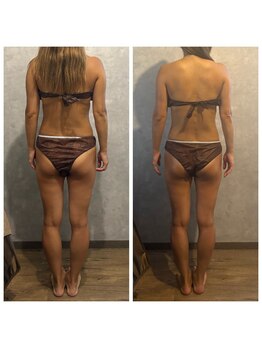 スタイル(Style.)/ビフォーアフター