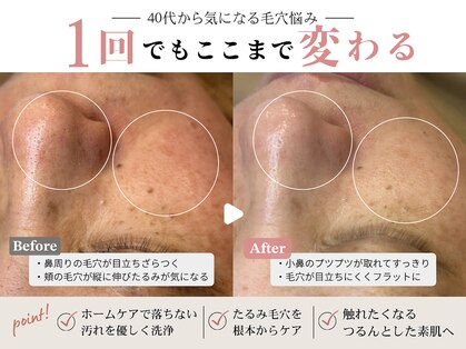 スコビ(SUKOBI)の写真