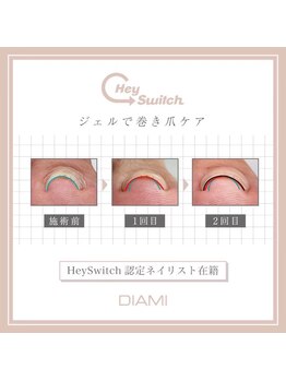 ネイルルーム ミズ(M’s)の写真/ヘイスイッチ！ジェルネイルで巻き爪ケアができる特殊なジェルで負担軽減しませんか？